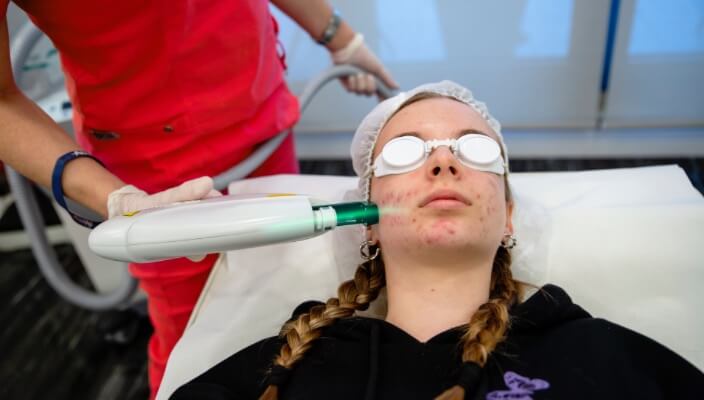 laser treatment on face)