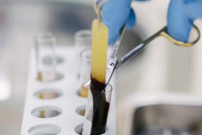 Pinehurst Laser — Platelet-Rich Fibrin PRF