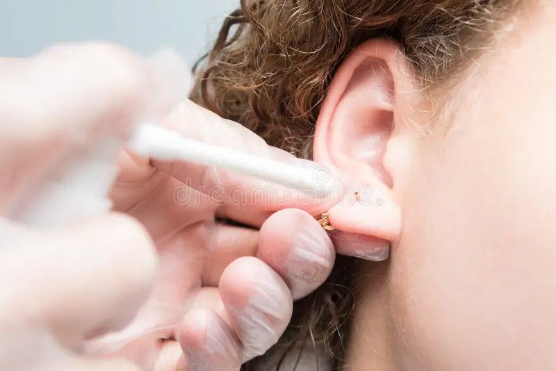 ear-piercing-treatment-decoration-close-up-170454539